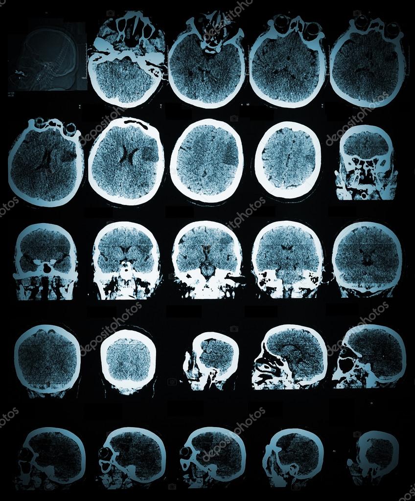 hintergrundbild scannen,medizinische bildgebung,medizinisch,kreis,schädel